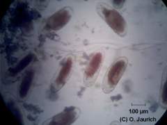 Eiballen der Mücke (Quetschpräparat) 150x HF