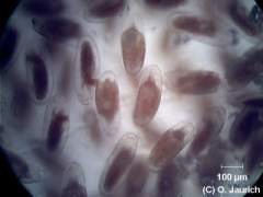 Eiballen der Mücke 150x HF