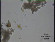 Amöbe 680x HF Fortbewegungsstudie Bild 1