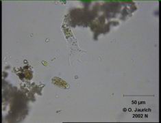 Amöbe 680x HF Fortbewegungsstudie Bild 2