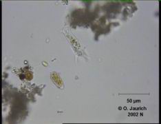 Amöbe 680x HF Fortbewegungsstudie Bild 3