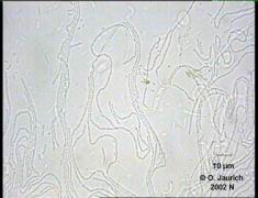Bakterien in Kahmhaut auf Blumenwasser 1100x HF SB