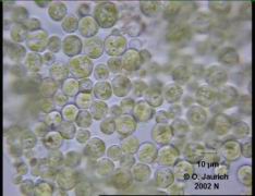 Grünalge Chlorococcum und Bakterien 1100x HF