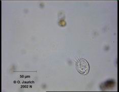 Ciliat Schildkrötentierchen 680x HF