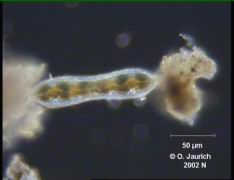 Eingeschnürte Sohlen-Kieselalge (Draufsicht) 680x DF