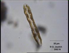 Eingeschnürte Sohlen-Kieselalge (Seitenansicht) 680x HF