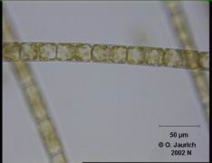 Faden-Kieselalge 680x HF Schärfeebene 1