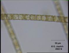 Faden-Kieselalge 680x HF Schärfeebene 2