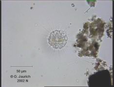 Sonnentier mit aufgenommener Kieselalge 680x HF