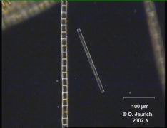 Stab-Kieselalge 340x DF