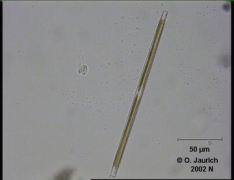 Stab-Kieselalge 680x HF