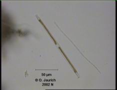 Stab-Kieselalge und Blaualgenkolonie 680x HF