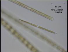 Stab-Kieselalge 680x HF