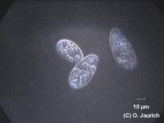 Grünes Pantoffeltierchen (Paramecium bursaria) 600x DF