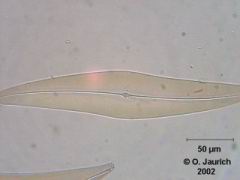 Kieselalage Pleurasigma angulatum 600x HF