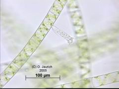 Pokaltierchen auf Schraubenalge 670x HF