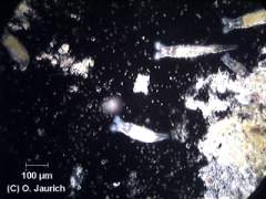 Rüssel-Rädertiere 150x DF