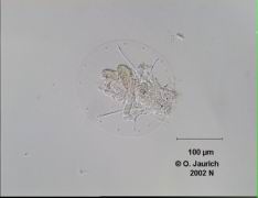 Schildkröten-Rädertier 340x SB, Hintergrund korrigiert