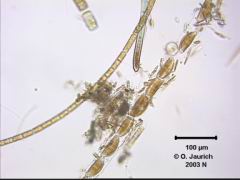 Schlauch-Kieselalge Cymbella prostrata 340x HF
