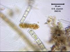 Eingeschnürte Sohlen-Kieselalge 670x HF