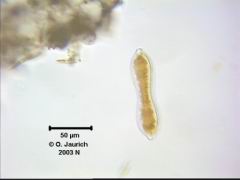 Eingeschnürte Sohlen-Kieselalge 670x HF