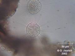 Bildserie: Verschmelzung und Separation zweier Sonnentiere 600x SB, Bild 4