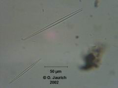 Stab-Kieselalgen 600x HF