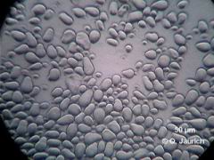 Stärkekörner aus Kastanie, 600x SB