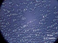 Stärkekörner aus Kastanie, gekreuzte Polfilter 600x HF