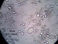 Stärkekörner aus Eichel, 600x SB