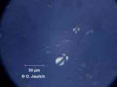 Stärkekörner aus Eichel, gekreuzte Polfilter 600x HF