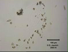Stielchen-Kieselalge 340x HF