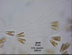 Stielchen-Kieselalge 1100x HF