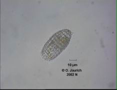 Tonnentierchen 1100x SB