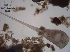 Trompetentierchen 150x HF