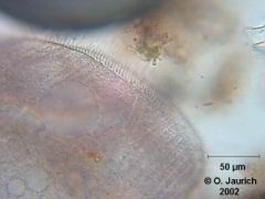 Trompetentierchen, Detail Mundbereich 600x HF