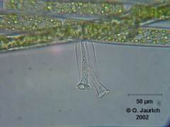 Vasentierchen 600x HF