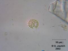 Grünalge: Warziges Zackenrädchen 600x HF