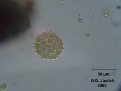 Grünalge: Warziges Zackenrädchen 600x HF