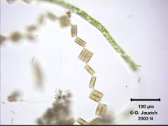 Zickzack-Kieselalge 340x HF