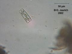 Zickzack-Kieselalge 600x HF