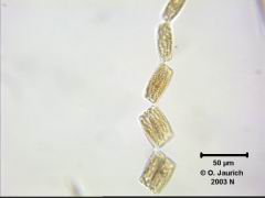 Zickzack-Kieselalge 670x HF