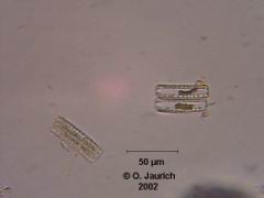 Zickzack-Kieselalgen 600x HF