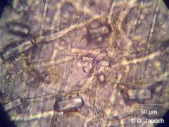 Oxalsäurekristalle in trockener Zwiebelschale,  Polfilter parallel, 600x HF