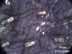 Oxalsäurekristalle in trockener Zwiebelschale,  Polfilter gekreuzt, 600x HF