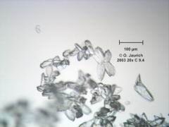 Calcitausfällung aus Brunnenwasser, Objektiv 20x, Brennweite 9,4 mm_HF