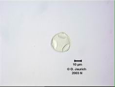 Haselnusspollen 1100x HF aus 3 Einzelbildebenen mittels CombineZ3 kombiniert, Einschluss in Glyzeringelatine