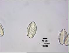 Rapspollen_1100x HF aus 5 Einzelbildern  mittels CombineZ kombiniert, Einschluss in Glycerin/Wasser