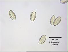 Rapspollen_680x HF aus 6 Einzelbildern mittels CombineZ kombiniert, Einschluss in Glycerin/Wasser