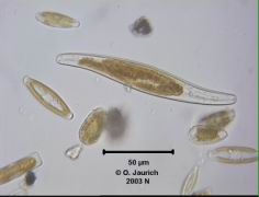 Sigma-Kieselalge 1100x HF